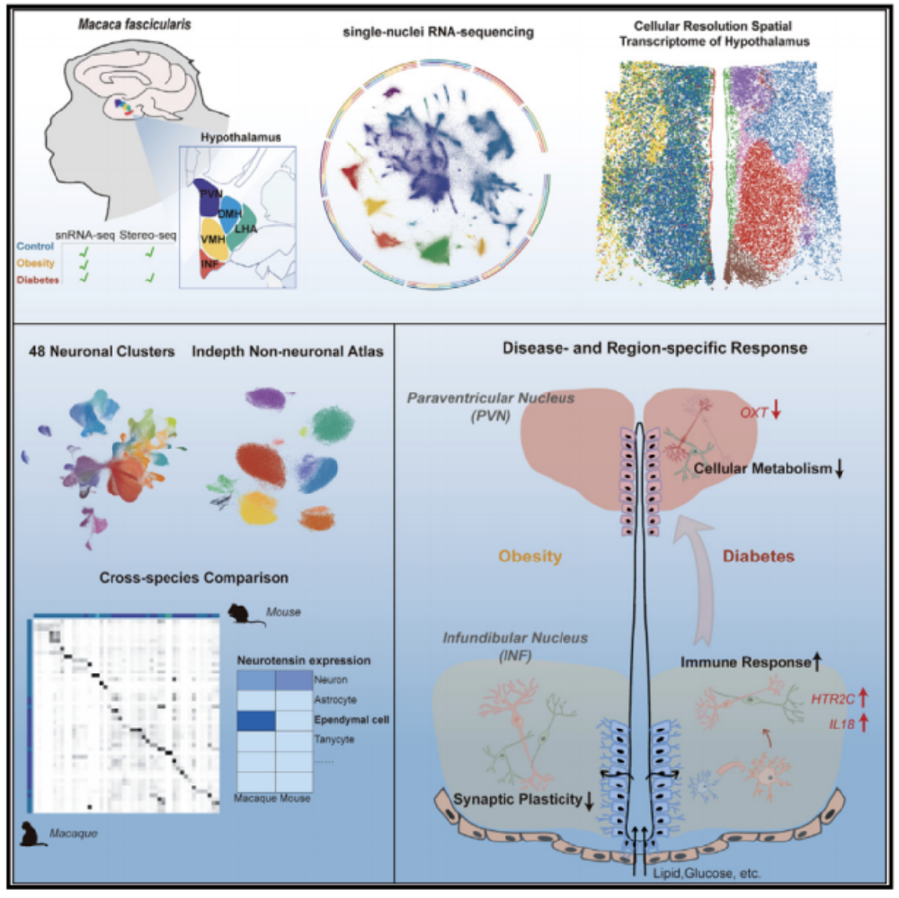 Cell Metab：受肥胖和糖尿病影响最强烈的脑区是哪里？复旦大学刘铁民/张智/孔星星等合作解密关键脑区