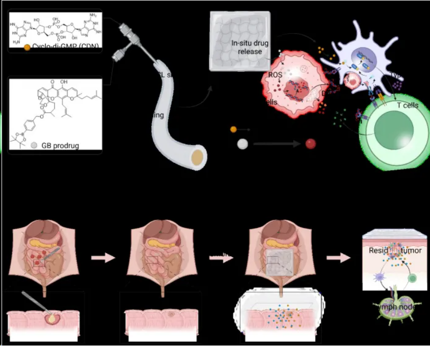 Adv Mater | 北京化工大学喻青松/甘志华等团队制备STING膜预防结直肠癌术后组织粘连和肿瘤复发