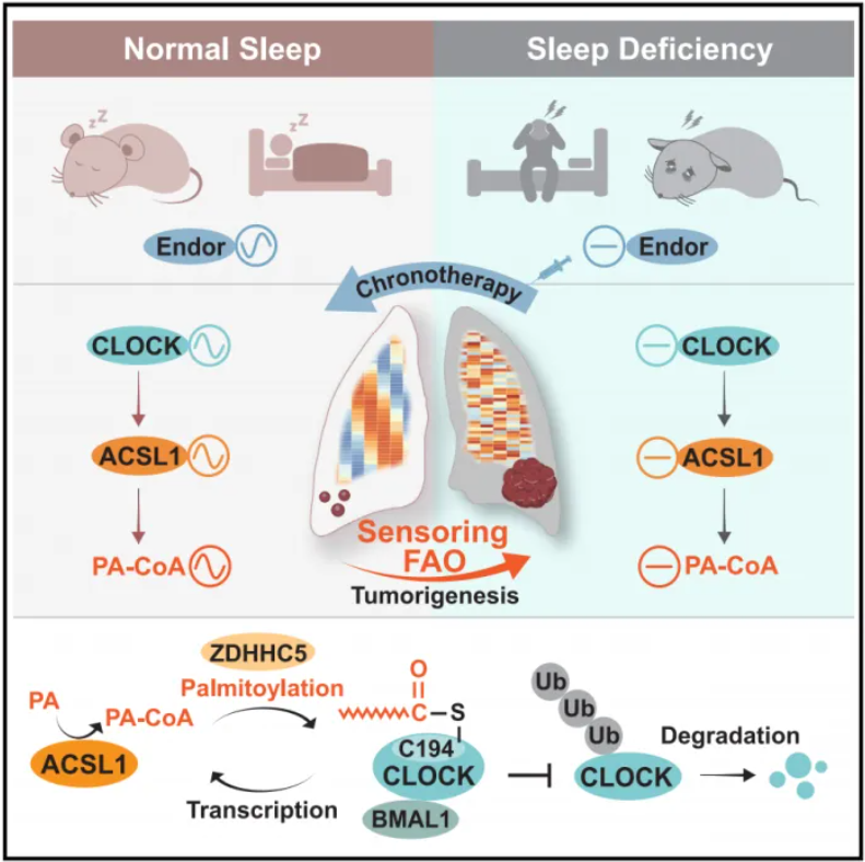 Cell Metab | 黎明治疗效果好？中山大学刘强等团队发现睡眠不足导致癌症的潜在机理