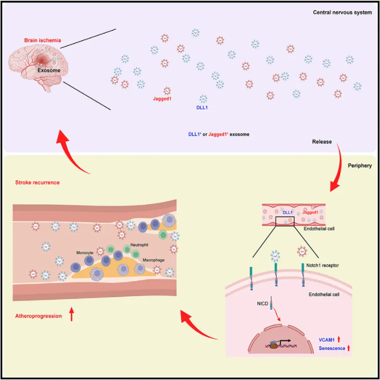 Immunity | 天津医科大学刘强/艾玎/周洁合作揭示了中风后血管事件复发风险增加的详细机制，并阐明了其治疗靶点